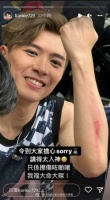 香港人气男团MIRROR开唱 成员摔落舞台手臂擦伤