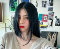 公司回应韩素希面部伤势：眼周有淤青 无需手术