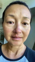 52岁港姐李绮虹素颜近照曝光，皱纹明显满脸红疹，笑称更年期问题