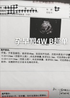 大衣哥儿媳陈萌晒产检单！自曝怀双胞胎，两人正在积极筹备婚礼