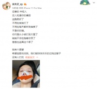 “冰柠檬”张兆艺遭家暴，被妈妈拿板凳砸，她鼻子淤青眼含泪光