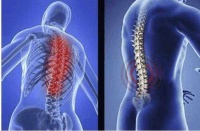 娱乐圈患不死癌症的明星：周杰伦上榜，还有吻遍娱乐圈女神的他