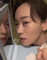 TVB前港姐冠军拍戏受伤！眼角伤口红肿，自曝险些变瞎子