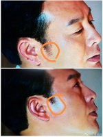 本来想夸夸颂文老师这么大年纪发际线保持的不错……