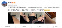 邓超被扎14针，宣布退出娱乐圈，孙俪只回复了9个字，却看哭无数人......