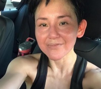 香港知名女星被曝与混血前任旧情复燃！滑雪摔断腿，正住院治疗
