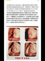 李嘉欣官宣怀孕，目前已经怀孕至少12周了，并晒出了CT孕儿照……