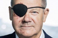 德国总理慢跑摔倒 变身独眼“海盗”