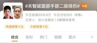 突发！知名男星脸部烧伤！