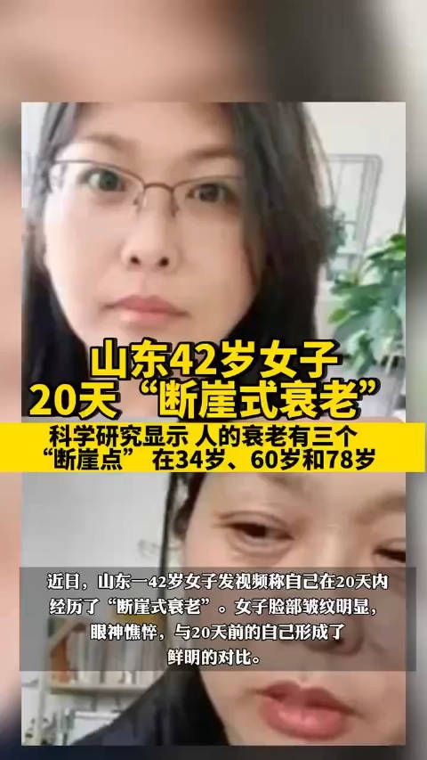 山东一42岁女子发视频称自己在20天内经历了“断崖式衰老”