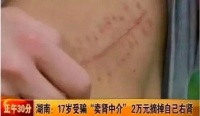 12年前，那个“卖肾换苹果手机”的高中生，获赔147万，现状令人唏嘘