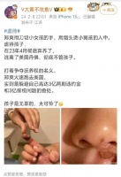 总结：郑爽虐孩子，切小女孩的手，用烟头烫小男孩的人中……