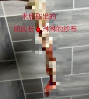 明星满舒克感染女友HPV！曾自称睡过73个女孩，抽加料烟自己验尿