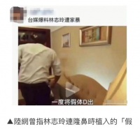 林志玲“毁容式”近照曝光，身材浮肿，面容苍老：结婚4年，她到底经历了什么？