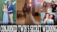 美国34岁连体双胞胎姐妹之一结婚，本人是老师，丈夫是男护士