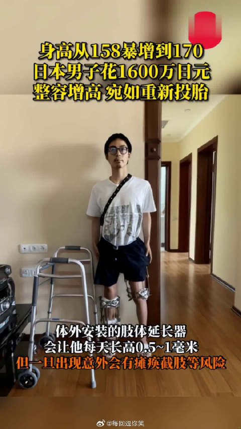 男子花1600万日元整容增高 ,身高从18暴增到170,宛如重新投胎