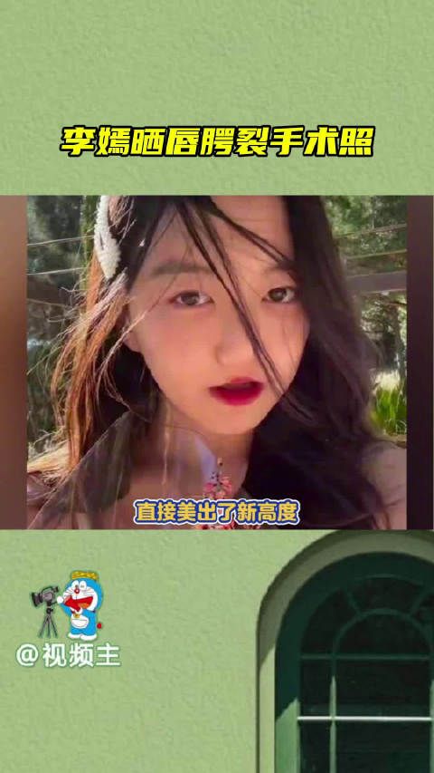 李嫣晒唇腭裂手术照,李嫣终于可以大大方方展示自己的美貌了…