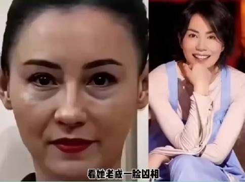 张柏芝一夜之间老成这个样子!