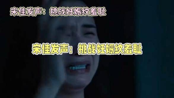 宋佳力挺妊娠纹:母爱无瑕,真实之美