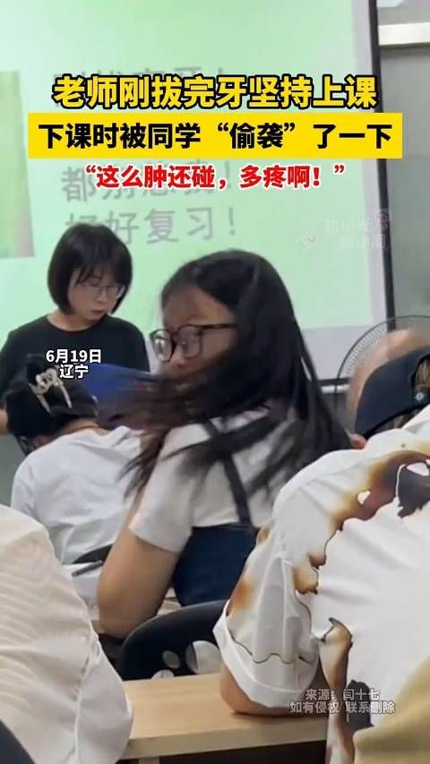 老师刚拔完牙坚持上课,下课时被同学“偷袭”了一下,这么肿还碰,多疼啊