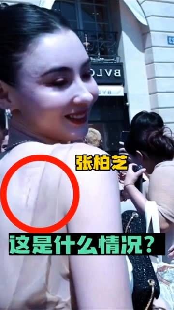 张柏芝亮相,有谁留意到她的背部?
