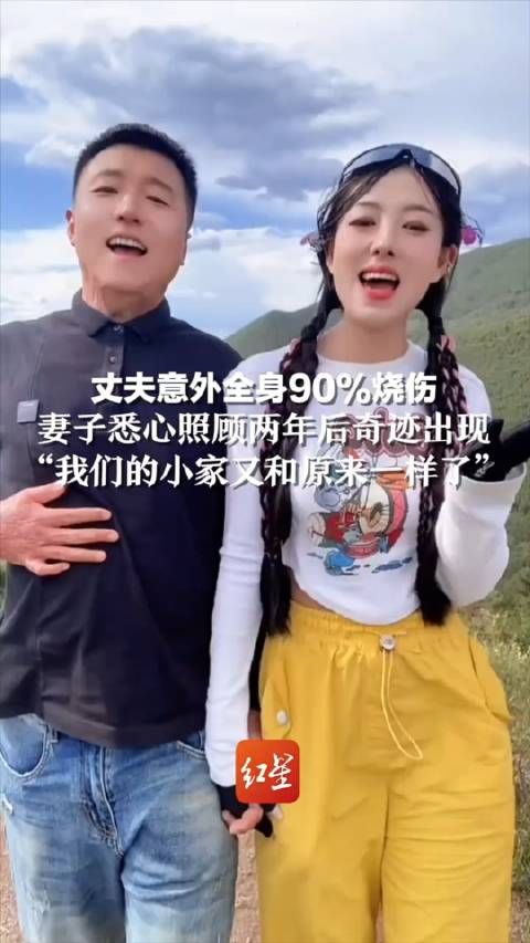 丈夫意外全身90%烧伤…