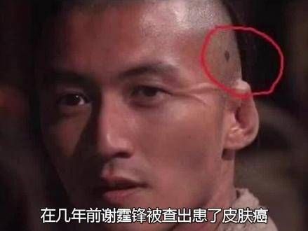 谢霆锋患上皮肤病,从始至终只告知了张柏芝,为何独独告诉她