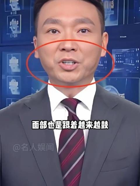 为何康辉面部越来越鼓？本以为是中年发福，真相曝光才知背后心酸