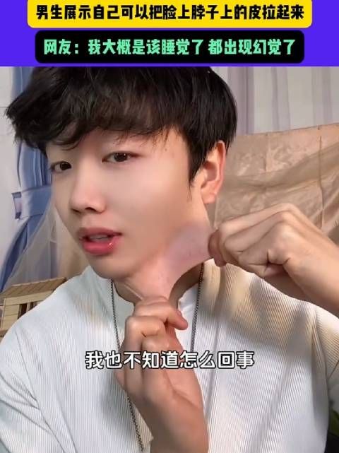 他这是不是戴了个假皮?