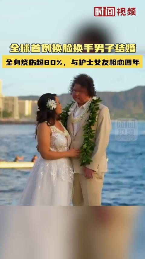 全球首例换脸换手男子结婚：全身烧伤超80%，与护士女友相恋四年