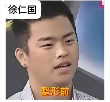 盘点韩国男演员整形前后!