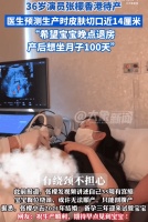 张檬香港待产胎儿已足月 医生称其腹中胎儿臀位绕颈切口14厘米