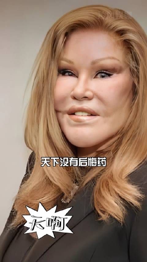 乔斯林去世5个月后整容四巨头现状曝光刘晓庆金老佛爷邵音音引关注