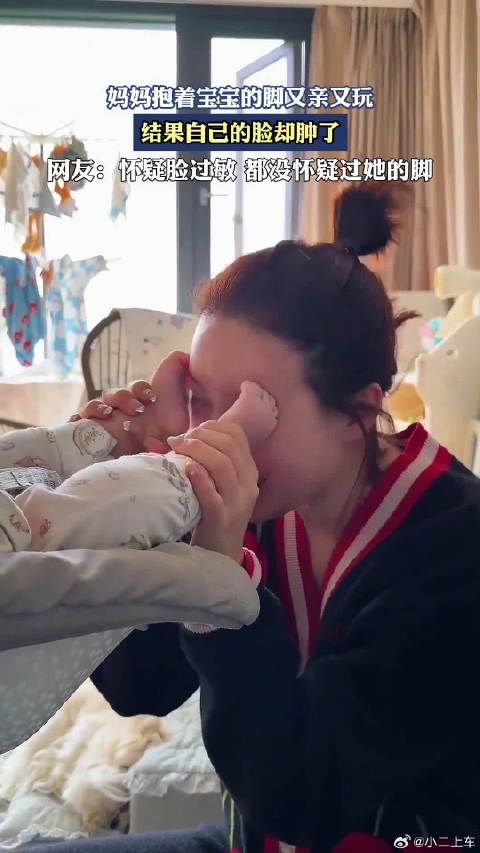 妈妈抱着宝宝的脚又亲又玩,结果自己的脸却肿了