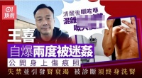 港星王喜自曝被两度侵犯后患肾衰竭，熟人作案没报警，需终身洗肾