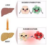 脂肪肝：不仅是肥胖问题，免疫系统的无声战场