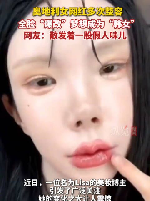 奥地利女网红多次整容 全脸“爆改”梦想成为“韩女”