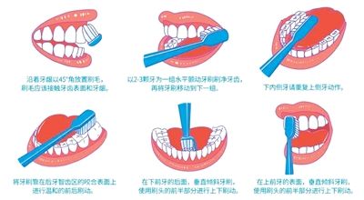 图为改良Bass法示意图。 北京口腔医院供图