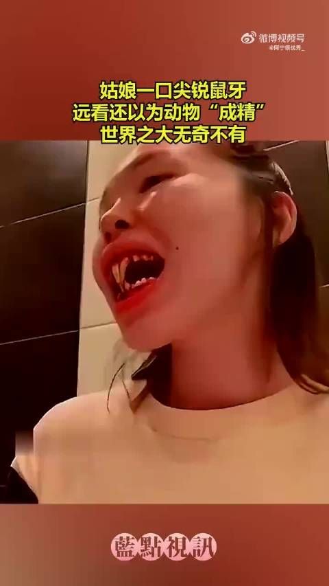 姑娘一口尖锐鼠牙,远看还以为动物“成精”,世界之大无奇不有