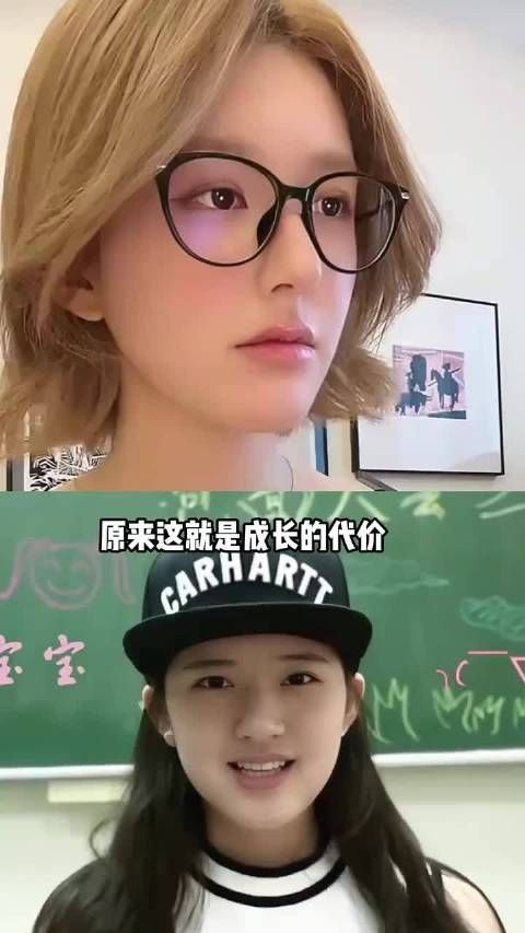 赵露思五年颜值变化，从婴儿肥到被质疑整容，背后经历了多少心酸