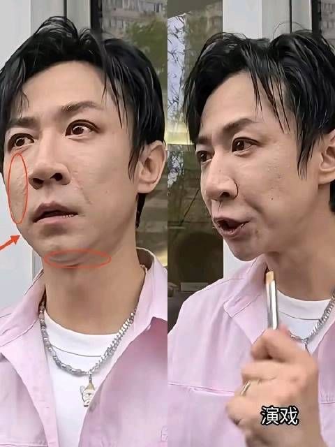 喜剧顶流张维伊形象掉线引热议,网友吐槽穿搭护肤不可忽视
