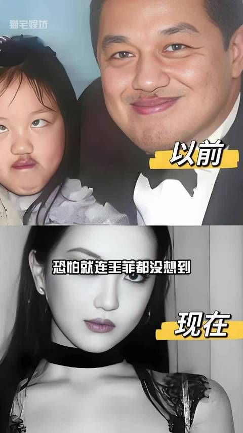 王菲李亚鹏之女李嫣兔唇痊愈，天后母亲低调守护成长