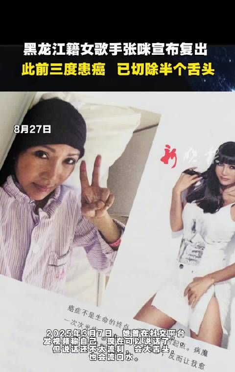 黑龙江女歌手张咪抗癌后复出,曾切除半个舌头