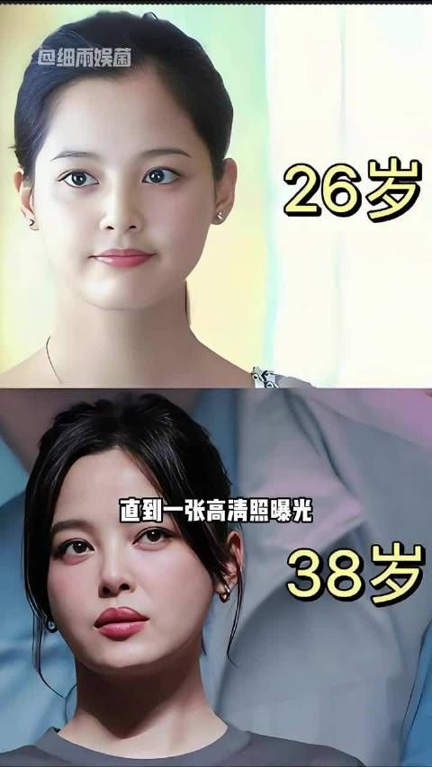 辛芷蕾三瓣唇高清照曝光,与孙俪殷桃同框引热议