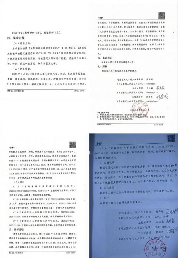 演员刘奕畅被曝酒后围殴他人涉嫌违法，已被关入看守所