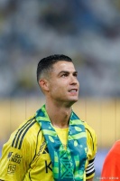 C罗可能做过多次整容手术