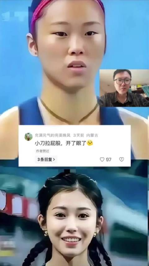 网友: 说实话的,这整的真成功