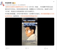 陈若仪谈嫁林志颖经历：被舆论攻击十年，曾被指责长得丑没才能