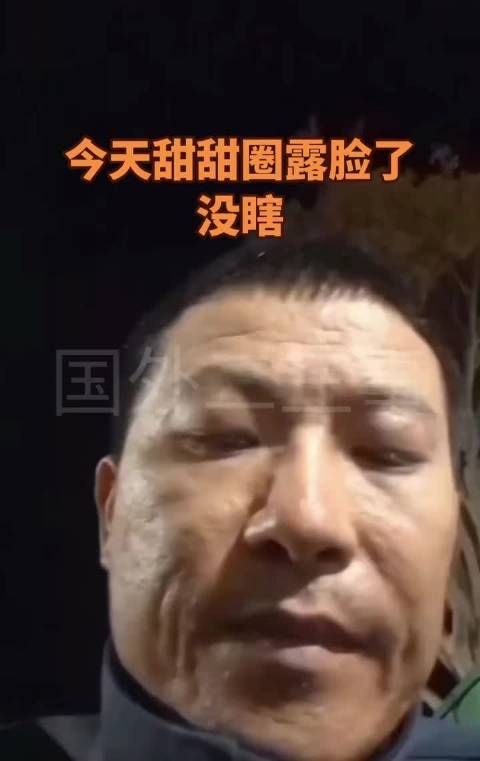 88年甜甜圈现满脸坑洼引热议