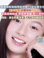 网友喊话七七不要整容